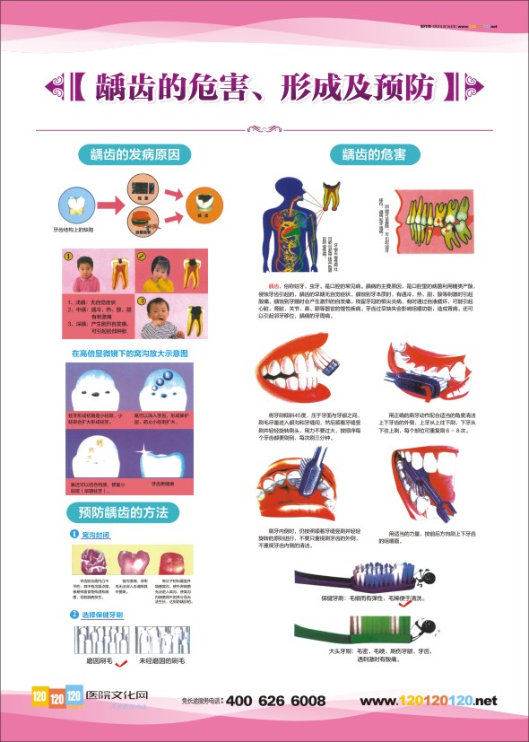 牙科診室圖片 牙科醫(yī)院圖片 口腔科掛圖-齲齒的危害、形成及預(yù)防